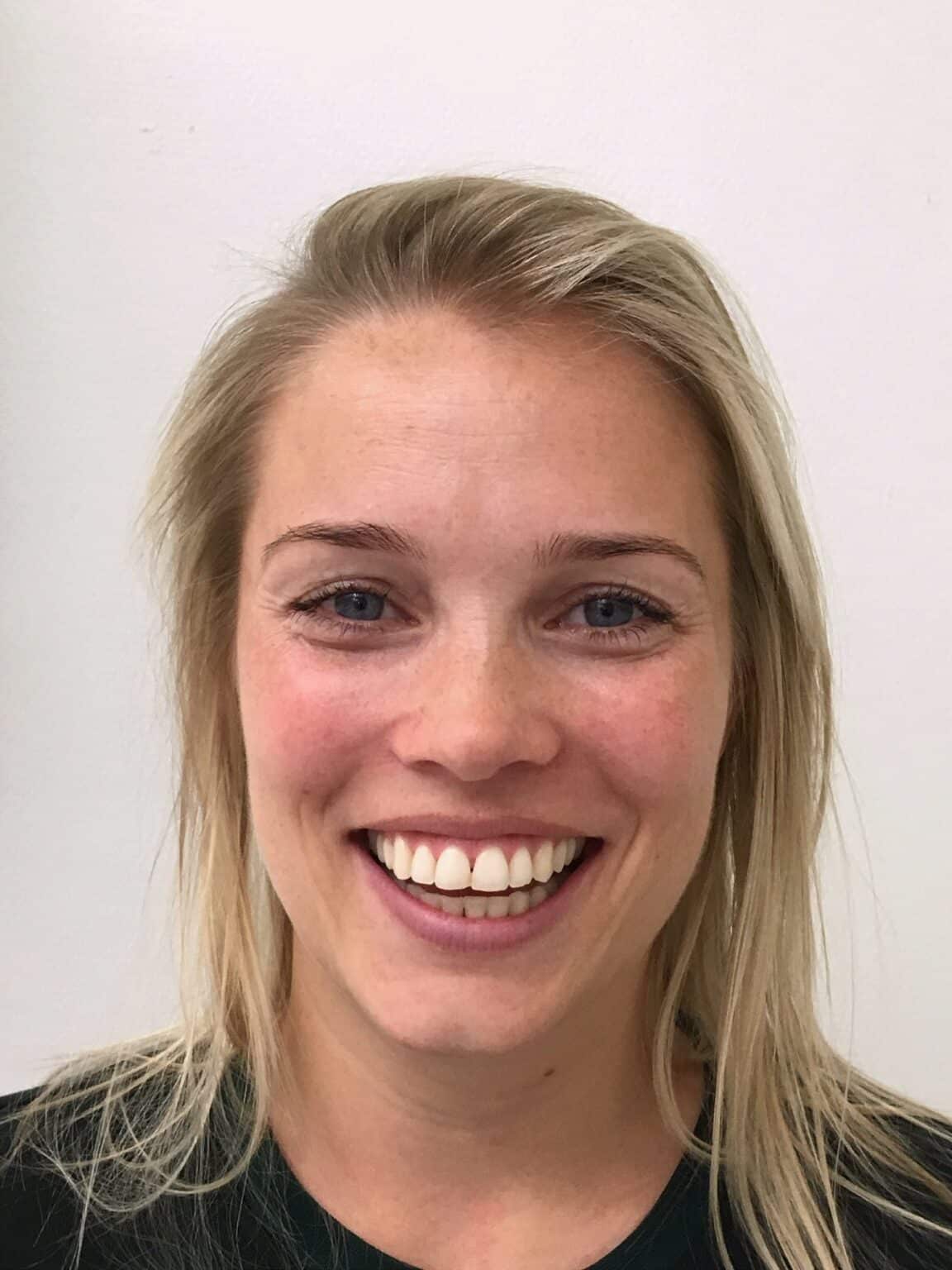 Invisalign i R&oslash;dovre, Hvidovre og Br&oslash;ndby